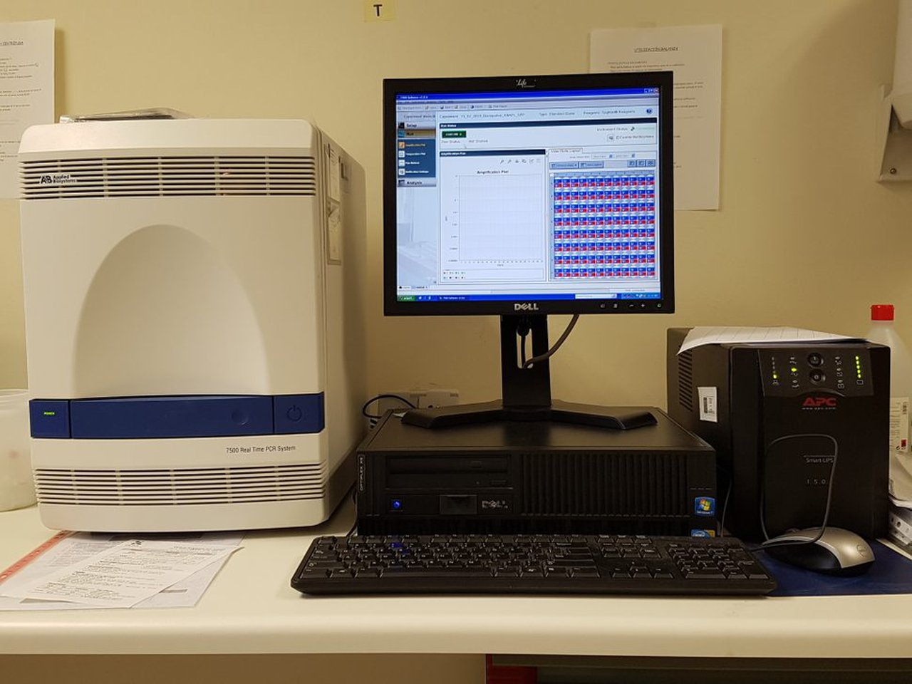 Diagnóstico de mamite bovina por qPCR: utilidade e aplicacións