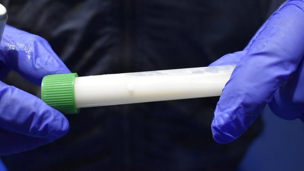 Vacina contra mastite: prevención eficaz e económica